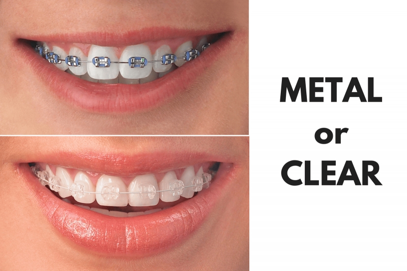 Orthodontics