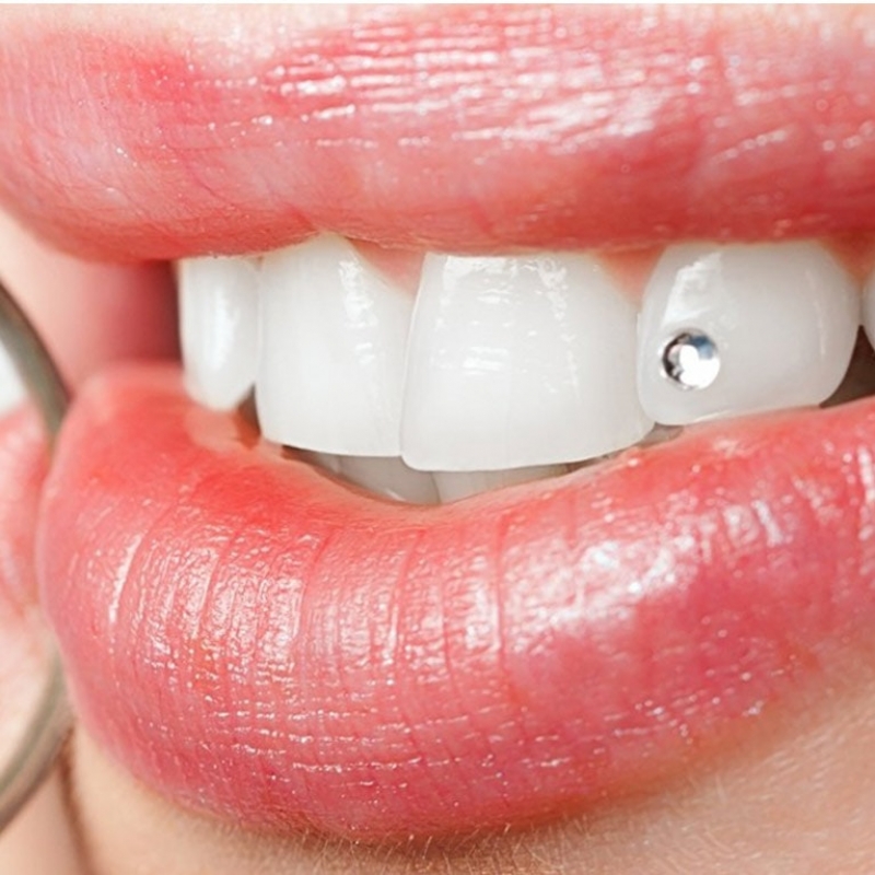 Teeth Jewelling