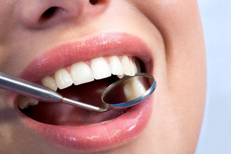 Ceramic &amp; Zirconia Crown &amp; Bridges